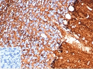 IHC staining of FFPE human brain tissue with S100B antibody (clone S100B/4138) at 2ug/ml. Negative c