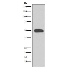 Cytokeratin 13 Antibody / KRT13