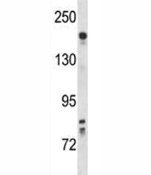 Kdr antibody western blot analysis in mouse lung tissue lysate. Predicted molecular weight: ~152 (im