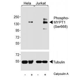Western blot analysis of lysates from human HeLa and Jurkat cell lines, untreated or treated with Ca