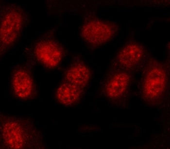 PRDM4 Antibody / PR domain zinc finger protein 4