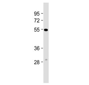 Western blot testing of human heart tissue lysate with CRCL antibody. Predicted molecular weight ~53