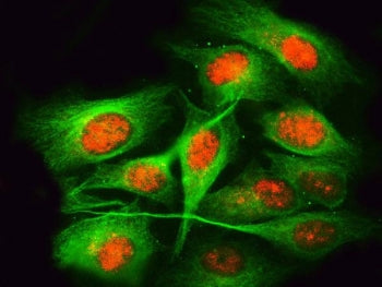 RPRD1B Antibody / C20orf77