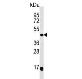 MEK4 Antibody / MKK4 / MAP2K4
