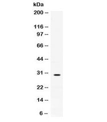 Western blot testing of human HEK293 cell lysate with Mast Cell Tryptase antibody at 0.5ug/ml. Expec