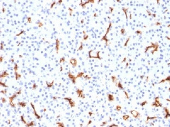 CFTR Antibody / Cystic Fibrosis Transmembrane Regulator