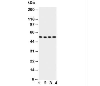 GLUT5 Antibody (Glucose Transporter 5)