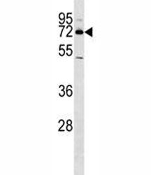 NURR1 Antibody (NR4A2)