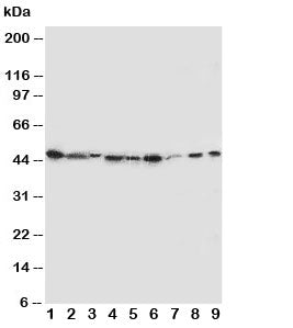 Western blot testing of IDO antibody and Lane 1: SMMC-7721; 2: A549; 3: human placenta; 4: SW620; 5: