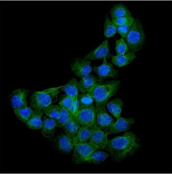 Syndecan-1 Antibody / CD138