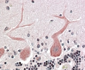 IHC testing of FFPE human cerebellum with CDC42BPA antibody at 4ug/ml. HIER: steamed with pH6 citrat