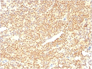 Cyclin D1 Antibody / CCND1
