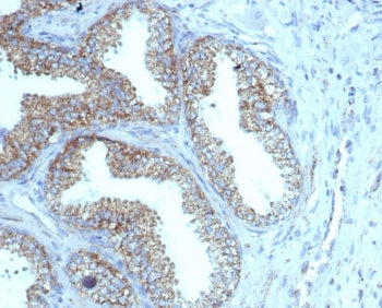 IHC staining of FFPE human prostate tissue with recombinant PMEPA1 antibody (clone rPMEPA1/6422). HI