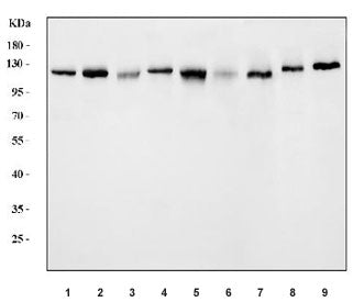 Western blot testing of 1) human HeLa, 2) human 293T, 3) human MCF7, 4) human A549, 5) human K562, 6