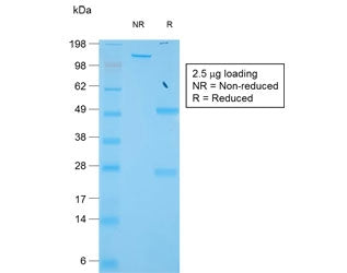 TIMP1 Antibody