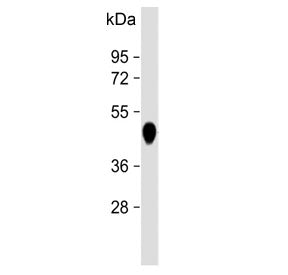 Western blot testing of human pancreas lysate with Carboxypeptidase B antibody. Predicted molecular 