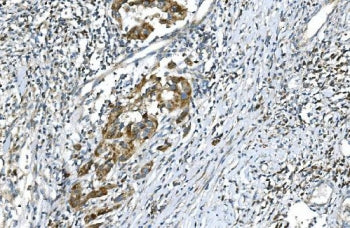 DR6 Antibody / Death Receptor 6
