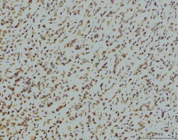 RPA32 Antibody / RPA2 / Replication Protein A2