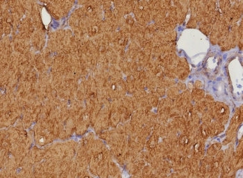 FABP3 Antibody