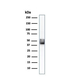 Western blot testing of human HCT-116 cell lysate with Keratin 8 antibody (clone KRT8/803).