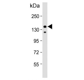 IRS2 Antibody / Insulin receptor substrate 2