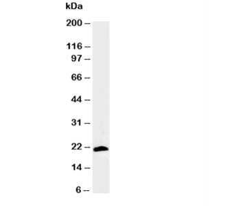 Myosin Antibody (Skeletal Fast)