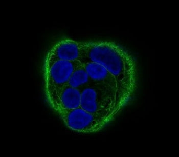 Cytokeratin 18 Antibody / KRT18