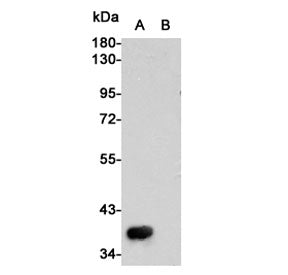MET Antibody / c-Met / HGFR