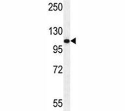 Androgen Receptor antibody western blot analysis in HeLa lysate. Predicted molecular weight ~99kDa.