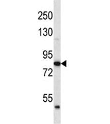 ABTB2 antibody western blot analysis in human K562 lysate. Predicted molecular weight ~114/93 kDa (i