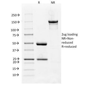 SDS-PAGE Analysis of Purified, BSA-Free VEGFR1 Antibody (clone FLT1/658). Confirmation of Integrity 