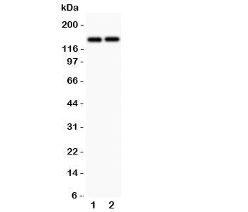 Collagen III Antibody / COL3A1