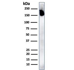Western blot testing of human spleen lysate with recombinant CD45RA antibody. Expected molecular wei