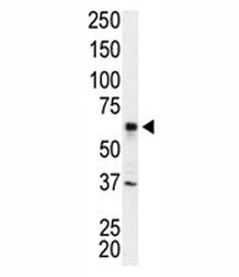IRAK2 Antibody