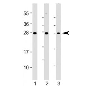 Western blot testing of ST8SIA1 antibody at 1:1000: Lane 1) human A2058 and 2) A375 cell lysate. Pre