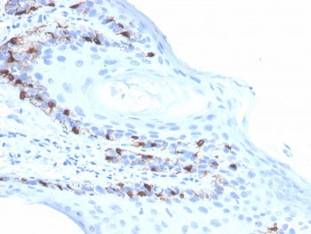 IHC staining of FFPE human skin with recombinant Melan-A antibody (clone rMLANA/4576). HIER: boil ti