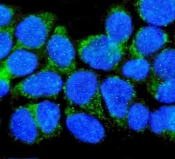 NGF Receptor Antibody / p75NTR / CD271