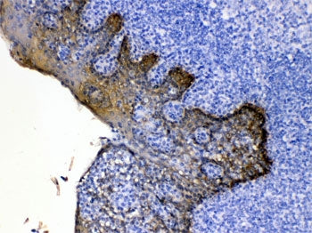 IHC testing of FFPE human tonsil tissue with Cytokeratin 5 antibody at 1ug/ml. HIER: steam section i