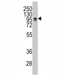 CBF Antibody (CEBPZ)