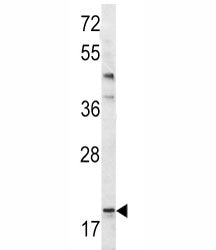 Bad Antibody