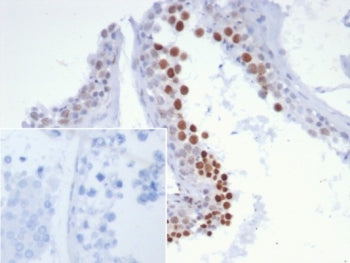 IHC staining of FFPE human testis tissue with NUT family member 1 antibody (clone SNUPN/7363R). Inse