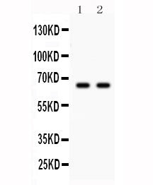 Western blot testing of Parkin antibody and Lane 1: U87; 2: mouse brain lysate. Expected molecular w