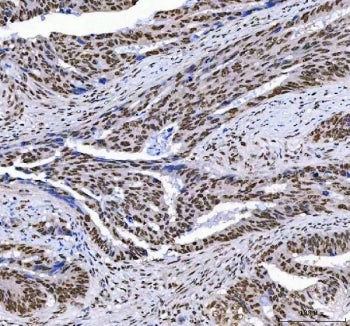 AHRR Antibody / Aryl Hydrocarbon Receptor Repressor