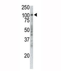 p100 Antibody (TPX2)