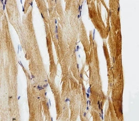 GFAP Antibody (Glial Fibrillary Acidic Protein)