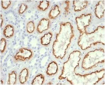 IHC staining of FFPE human kidney tissue with recombinant Cdc20 antibody CDC20/7026R) at 2ug/ml. HIE