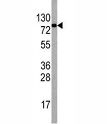 EIF4B Antibody