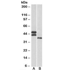 FCRL1 Antibody
