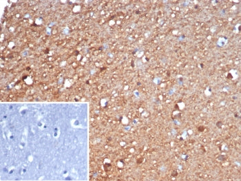 NSE Antibody / Neuron Specific Enolase