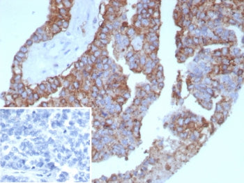 Pan-HLA Antibody MHC II (DP/DQ/DR)